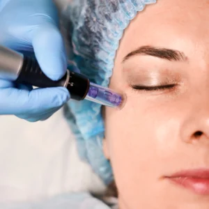 female client having fractional mesotherapy in beauty salon1 fe7ae309bf4c1d5b2716635520828696 1024 1024