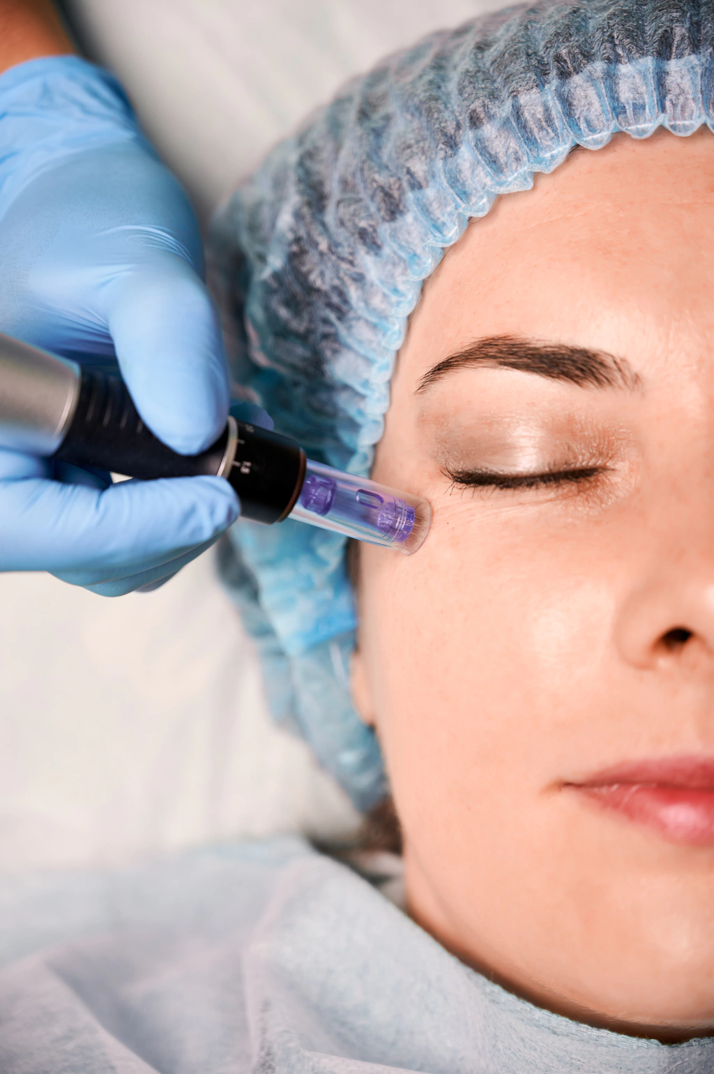 female client having fractional mesotherapy in beauty salon1 fe7ae309bf4c1d5b2716635520828696 1024 1024 female client having fractional mesotherapy in beauty salon1 fe7ae309bf4c1d5b2716635520828696 1024 1024