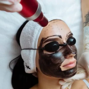 osmetologos mano haciendo peeling carbono hardware joven bonita mujer cliente seguridad 361821 11721 0a15178170b79e3c5c16635529963226 1024 1024